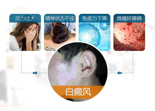 世界白癜风日帮女郎白癜风病案征集暨名医讲堂开课 1560844764909891.jpg